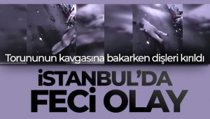 İstanbul’da feci olay kamerada: Torununun kavgasına bakarken dişleri kırıldı
