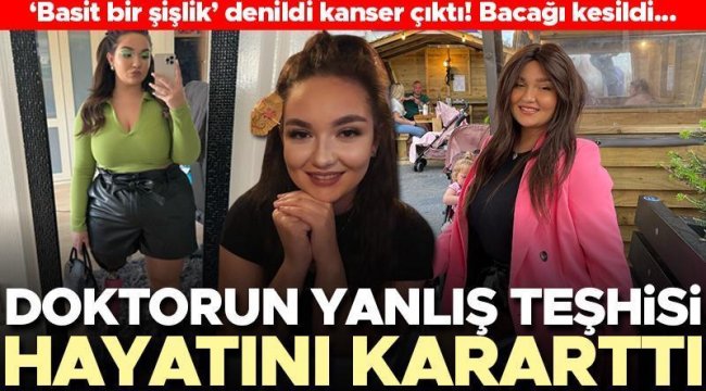 Yanlış teşhis yüzünden hayatı karardı! Doktorların 'hizmetçi dizi' dediği hastalık kanser çıktı... Genç kadının bacağı kesildi